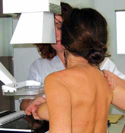  mamografía en la Unidad Móvil